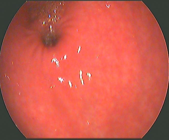 Share Your Opinion on this UGI Endoscopic Image