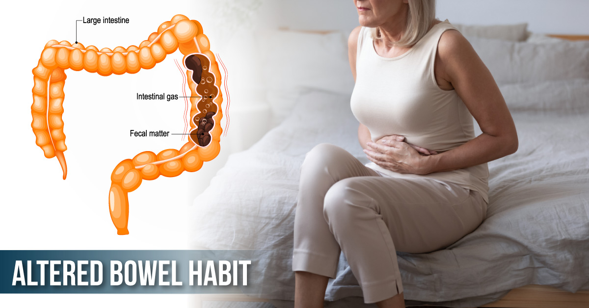 Diagnose This Case of an Altered Bowel Habit