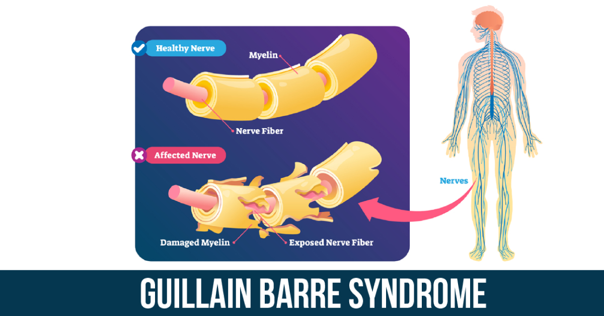 Rare Auto-Immune Disease Treated Successfully In Madurai