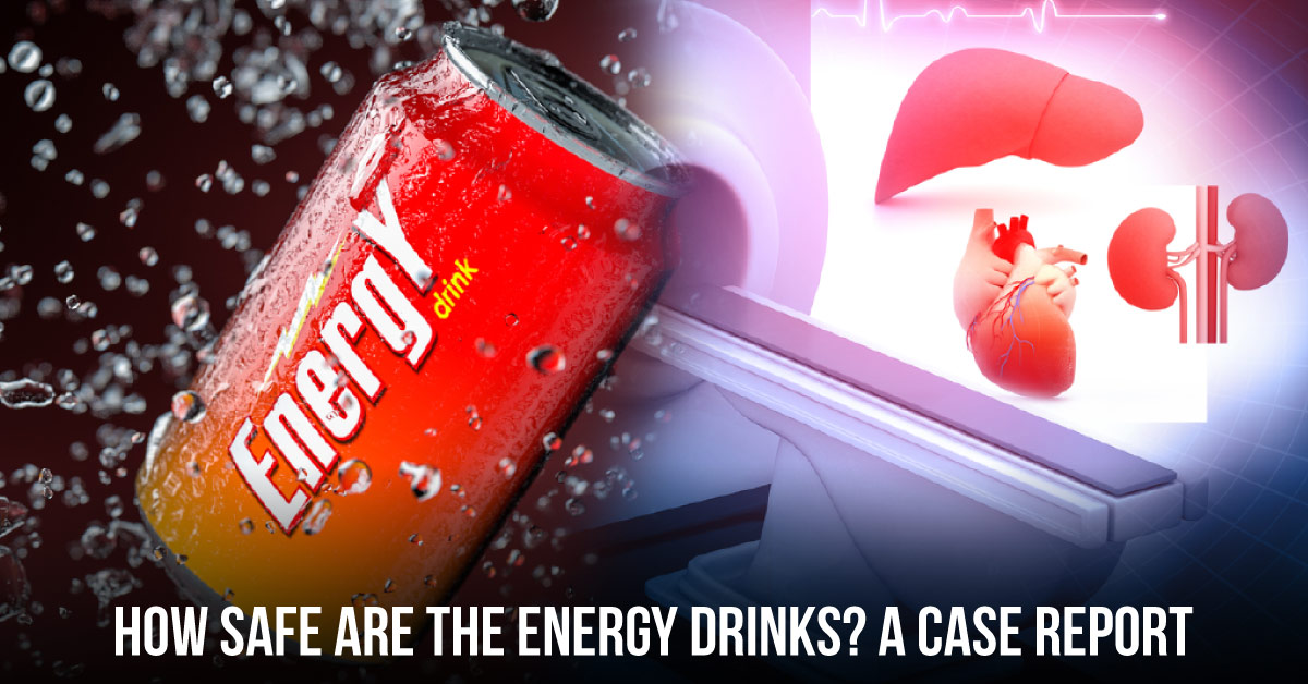 Complications of Energy Drink Consumption: A Case Report