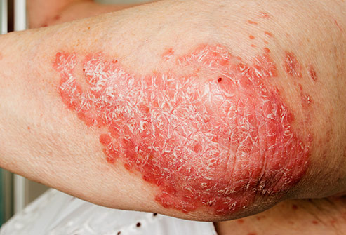 Spot The Diagnosis