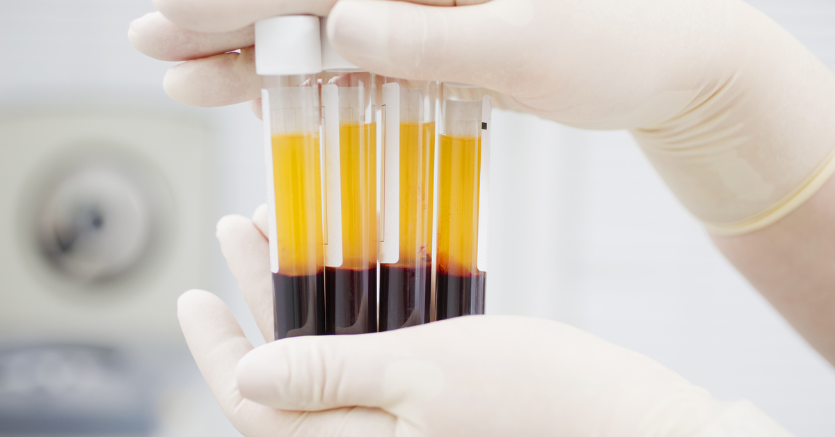 Plasma From Recovered Patients Used To Treat Coronavirus A Valid Approach, WHO Says