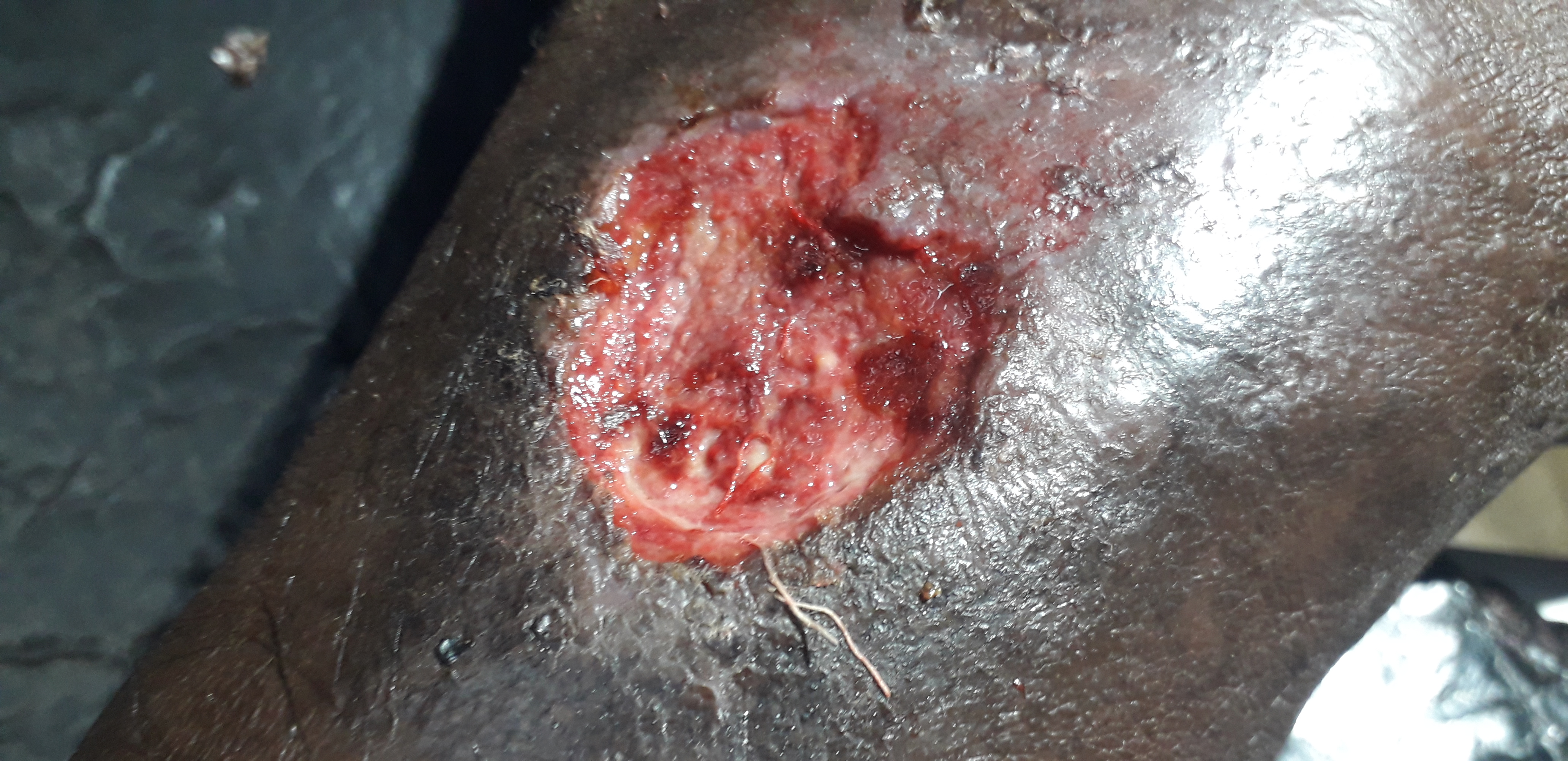Spot The Diagnosis And Discuss Management