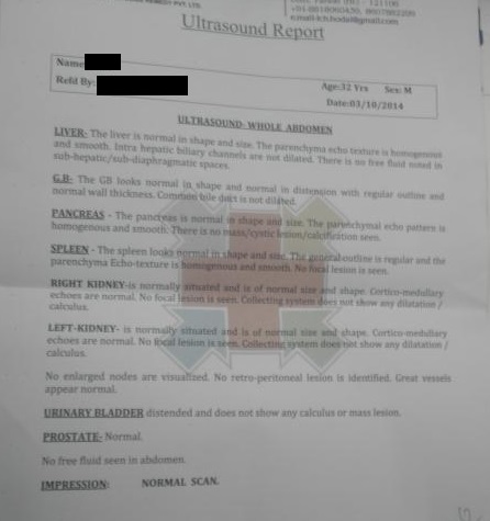 Multiple Liver Abscess Successfully Treated In OPD Management