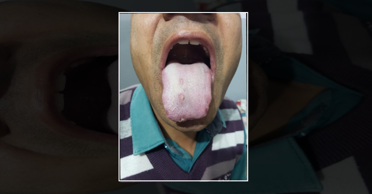What Are These Lesions?