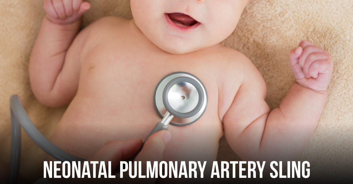 A Case of Neonatal Pulmonary Artery Sling