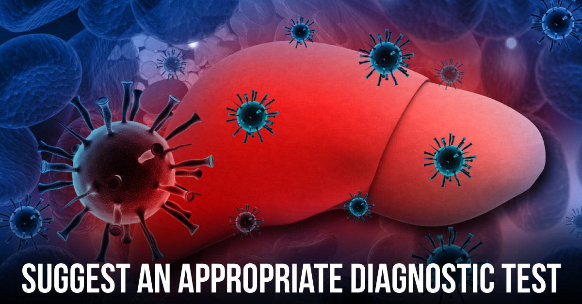 Select the Most Appropriate Test to Confirm the Diagnosis