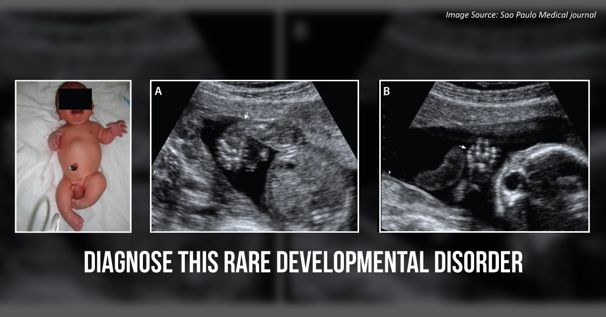 Decipher the Diagnosis in This Unborn Child