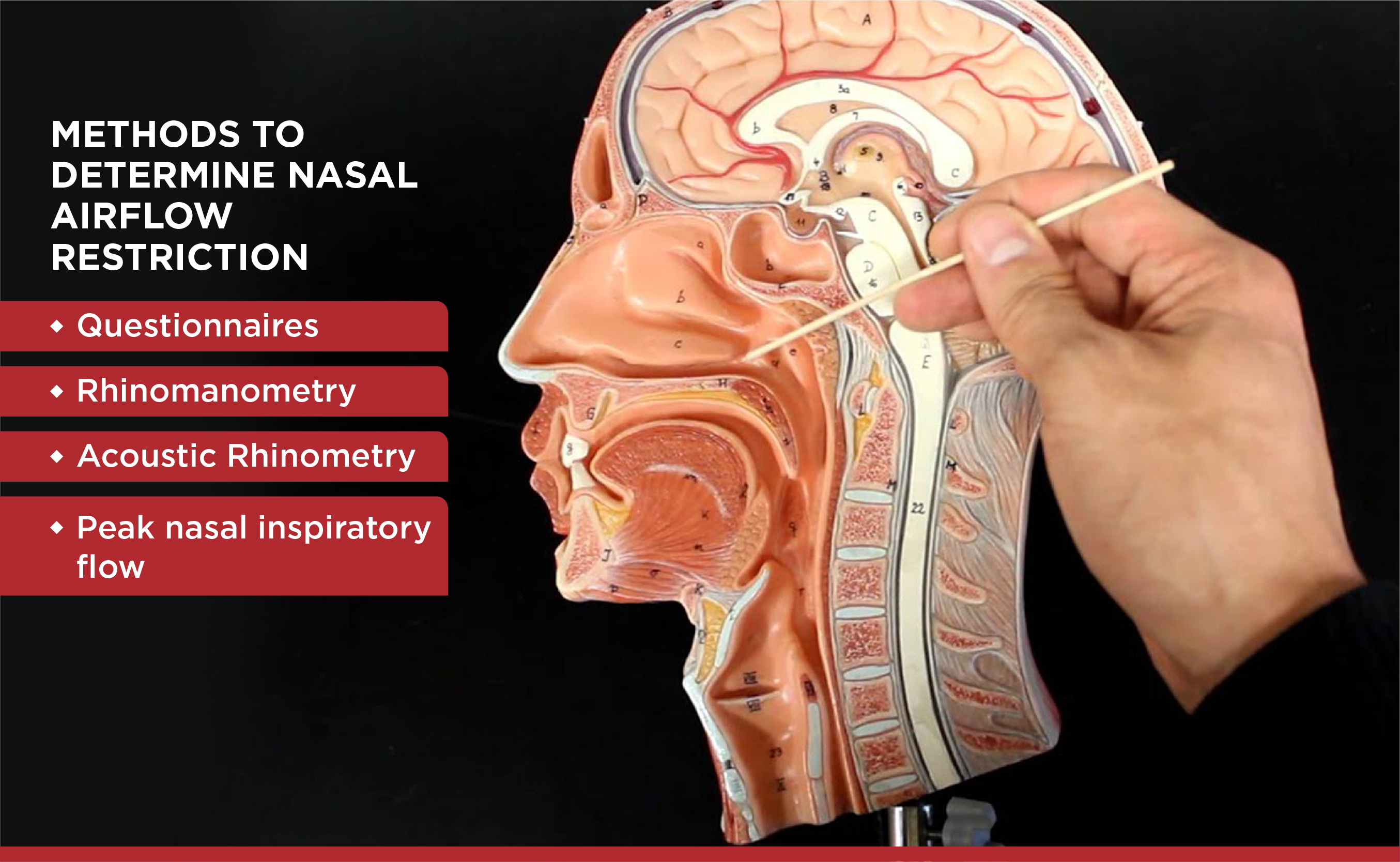 Subjective Perceptions Vs. Objective Measures For Determining Nasal Airflow Restriction