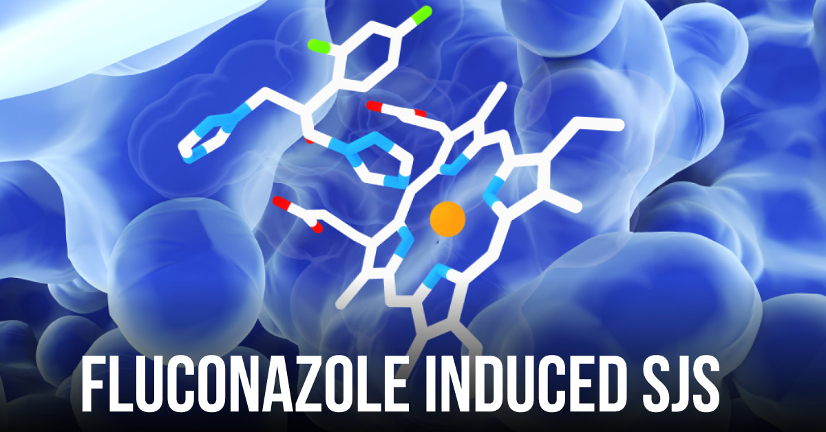 Fluconazole Induced Stevens-Johnson Syndrome