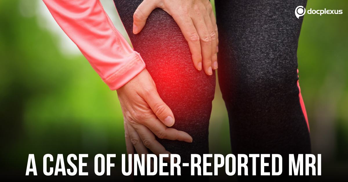 The Swollen Knee – How Reliable Is Healthcare?