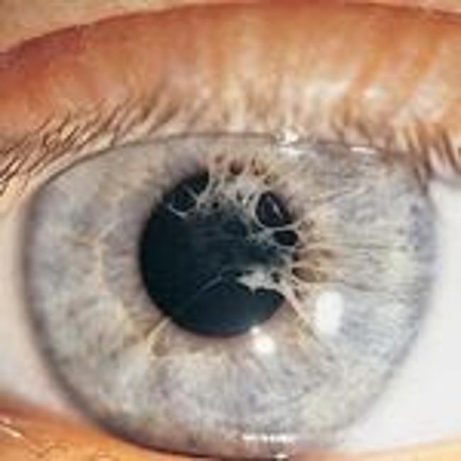 Spot The Given Diagnosis