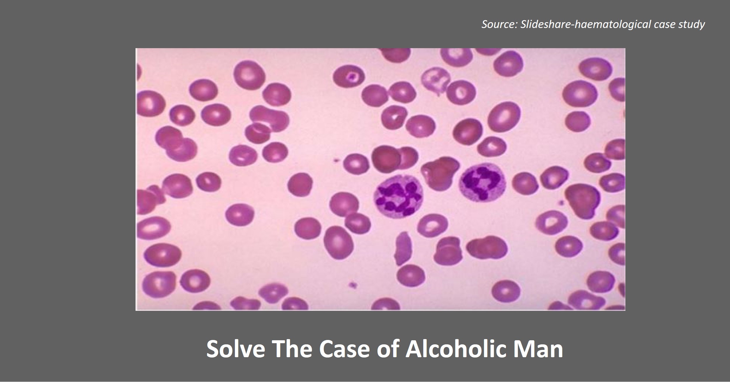 Identify the Cause of Malaise and Weakness