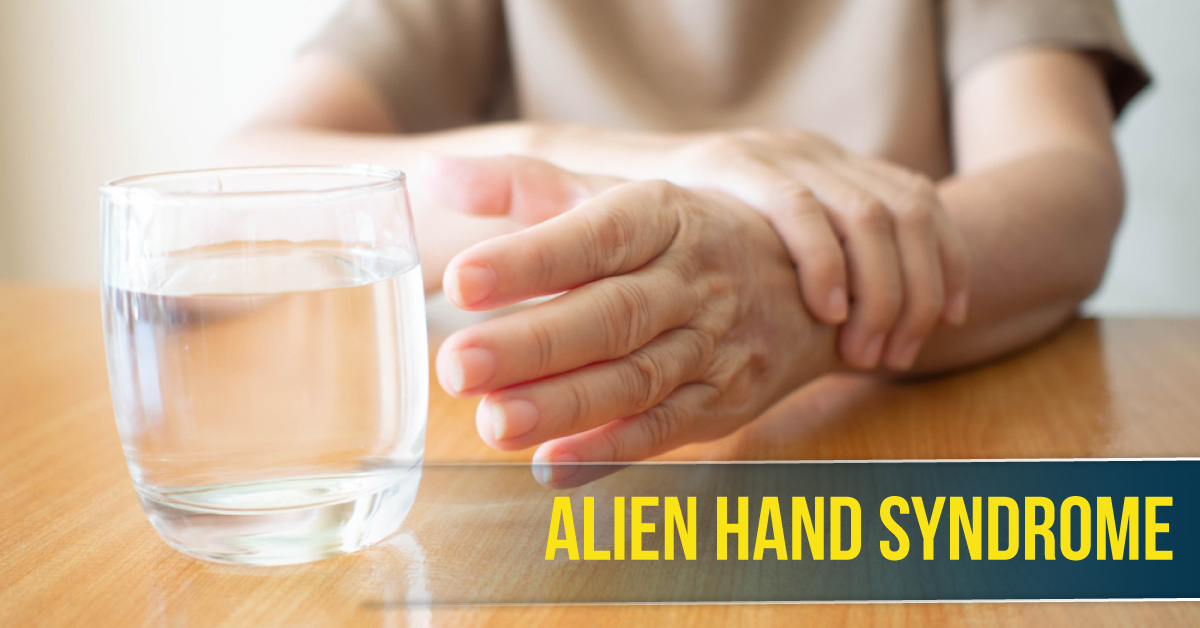 Alien Hand Syndrome: A Rare Disorder