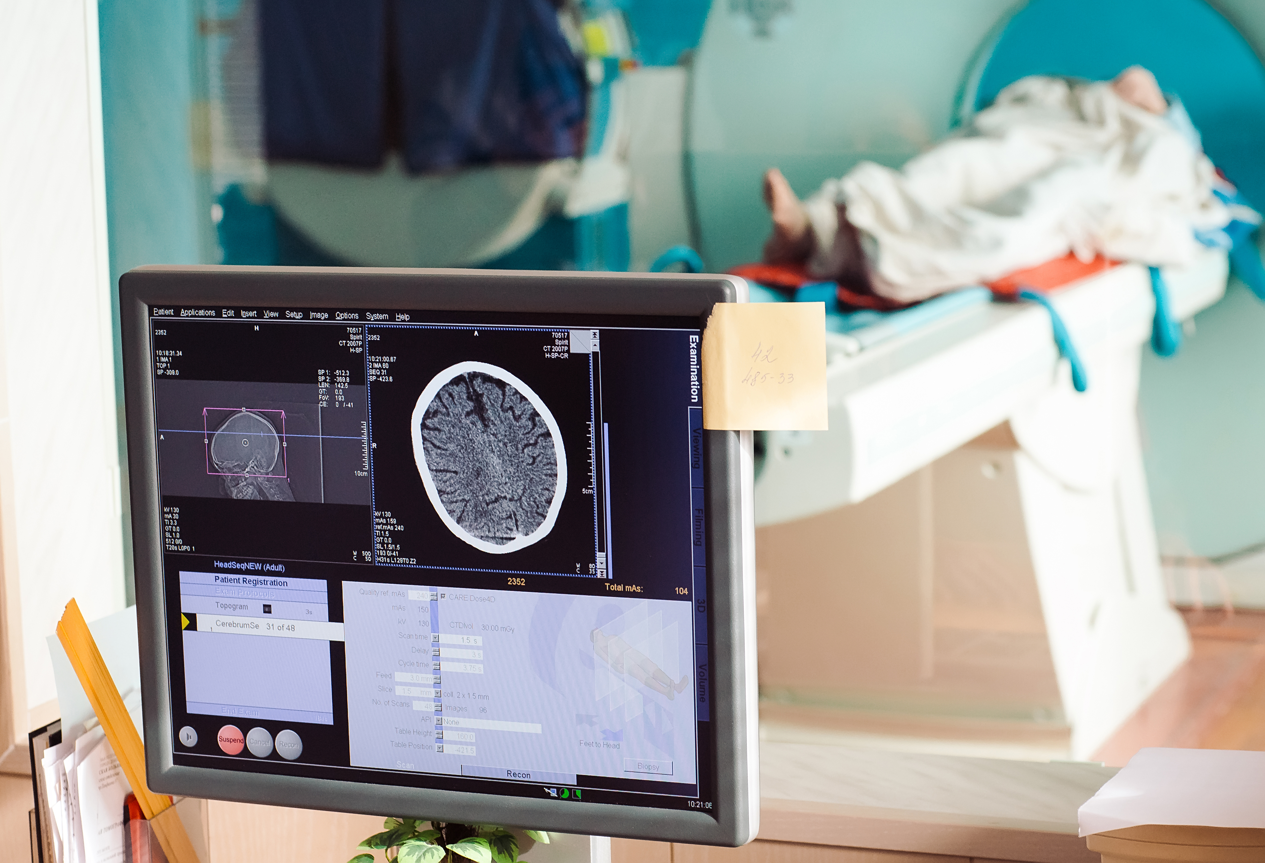 French Society of Neuro-radiology Consensus Guidelines 2020