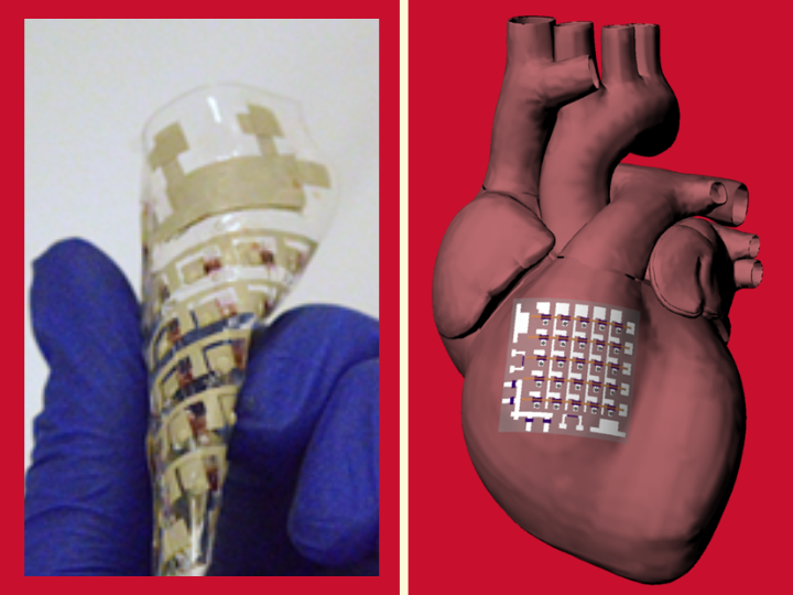 Flexible Patch Monitors And Treats The Beating Heart