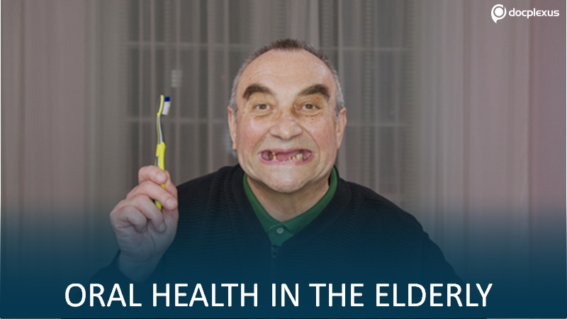 Oral Conditions Among The Elderly