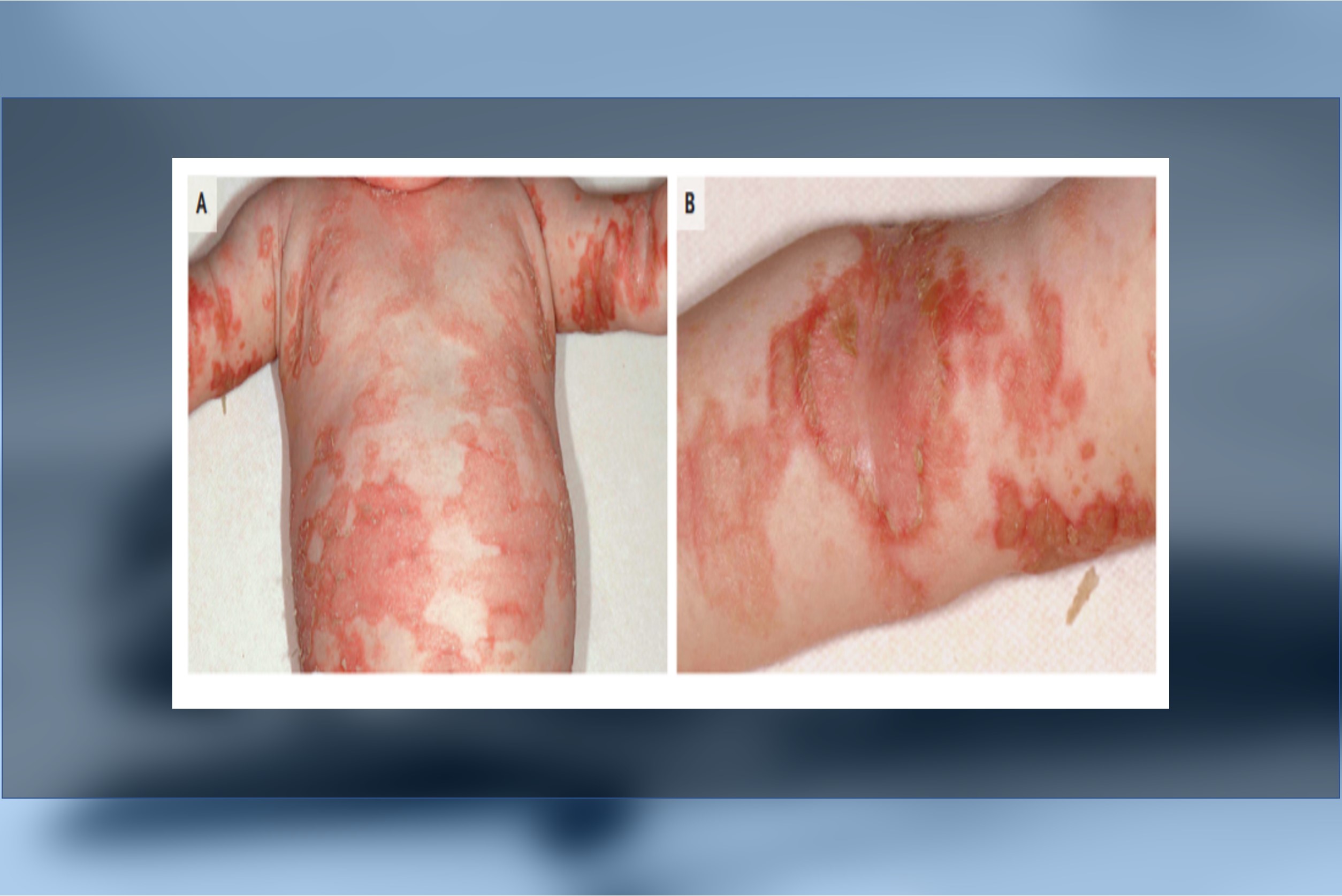 Can You Diagnose the Condition In This Child?