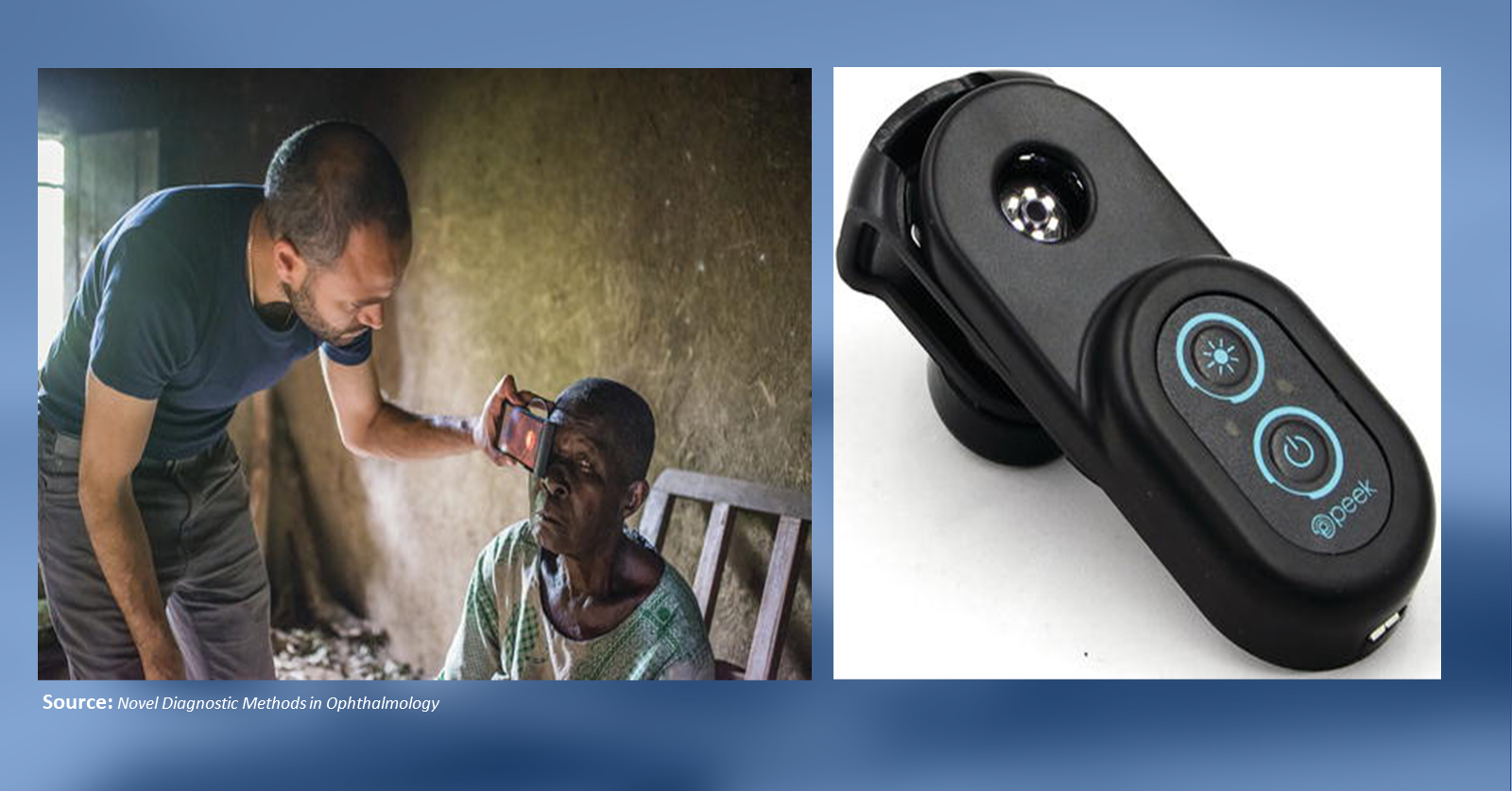 Smartphone Compatible Refractive Error Testing Kits