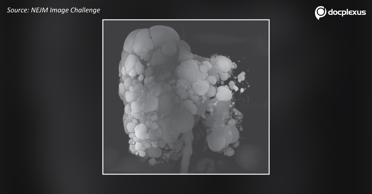 Can You Diagnose This Patient?