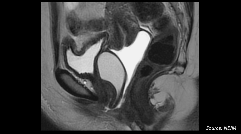 Can You Diagnose the Patient’s Condition From the Given Image?