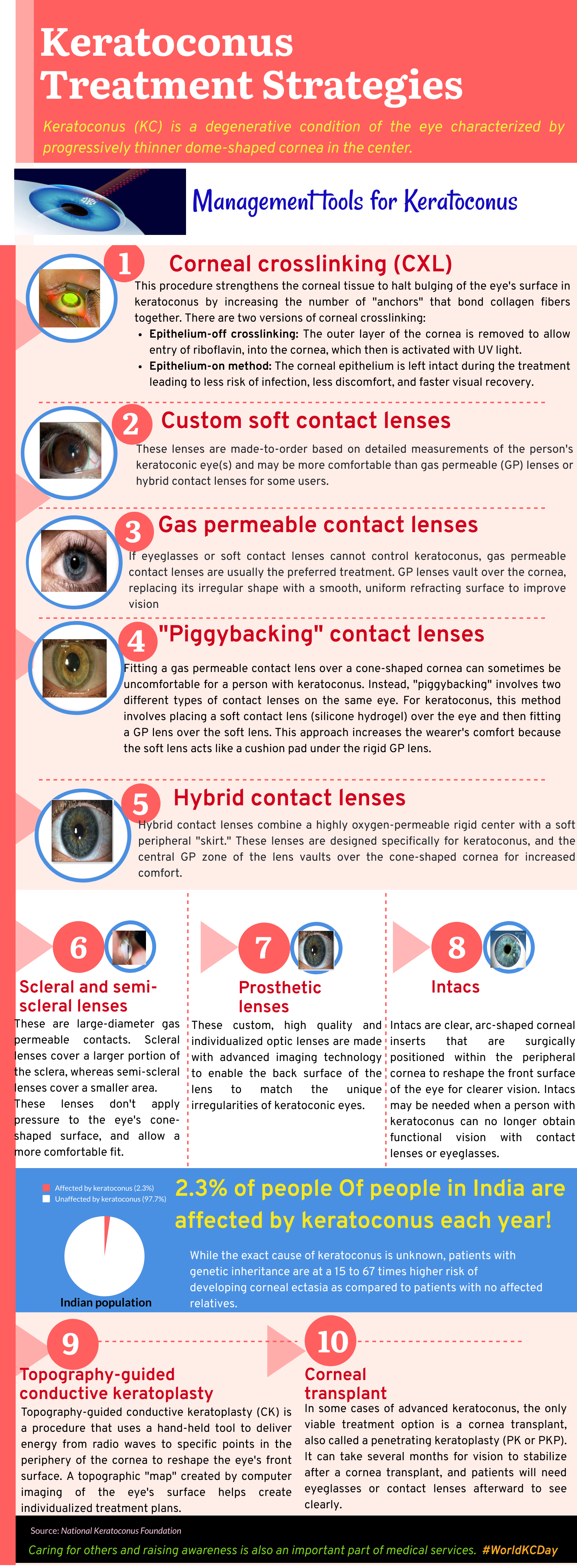 World Keratoconus Day
