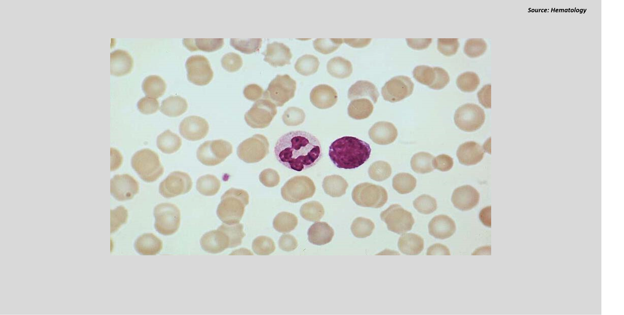 Microscopy Based Diagnosis Of A Rare Congenital Disorder