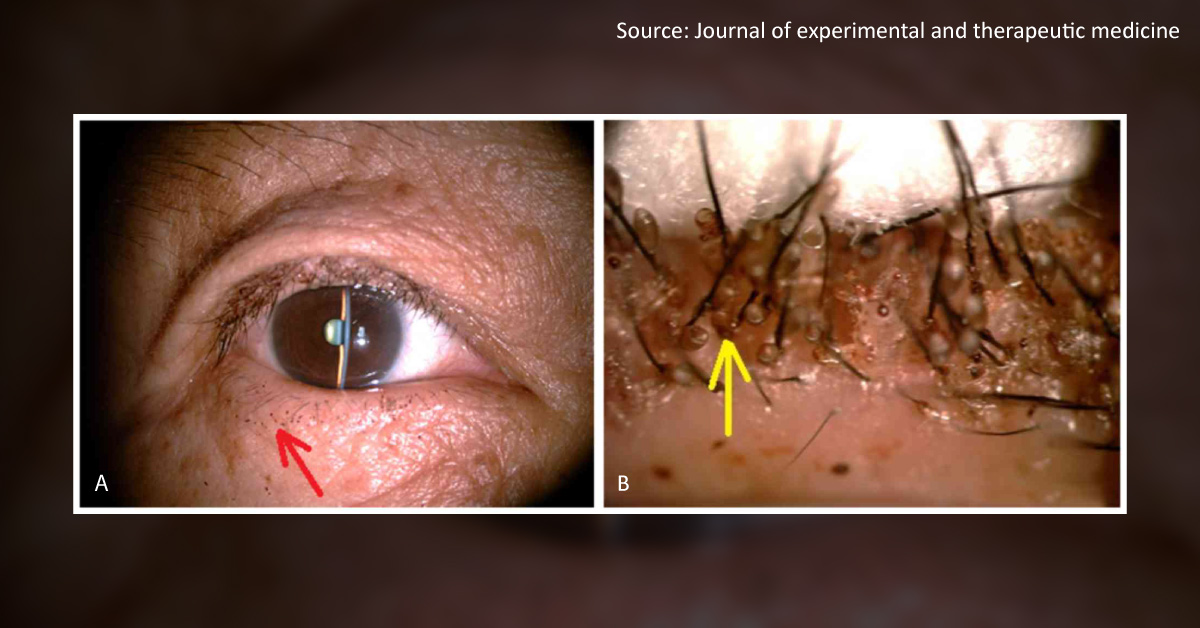 Can You Diagnose The Condition In This Woman?