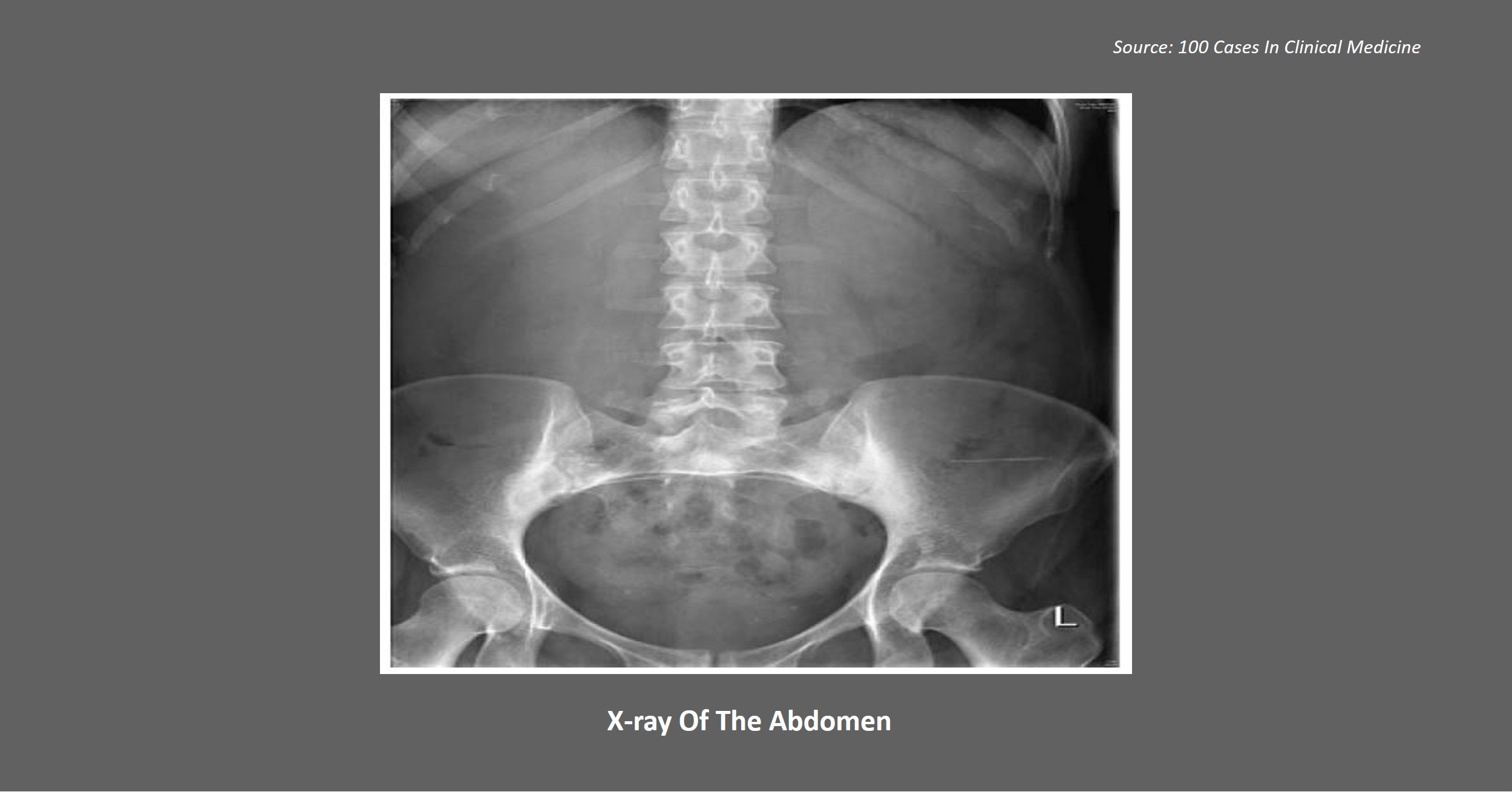 Diagnose This Patient with Severe Abdominal Pain