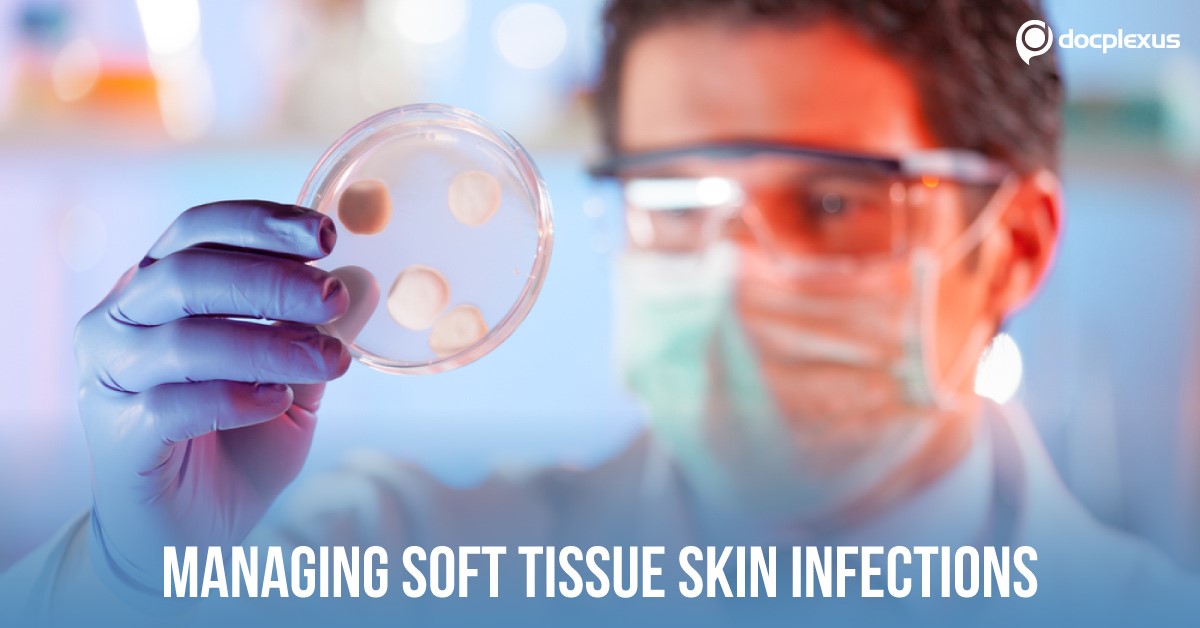 Practice Guidelines for Diagnosis and Management of SSTIs