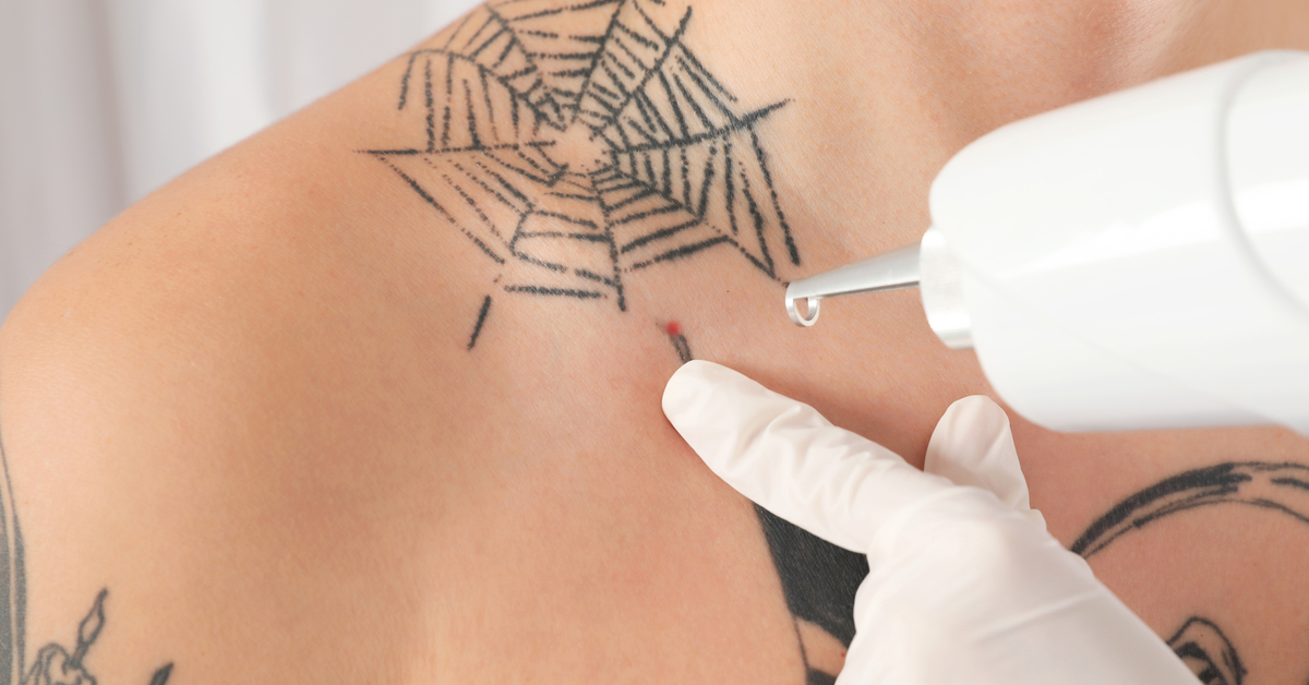 Case of a Young Man with Neck Mass Adjacent to Tattoos