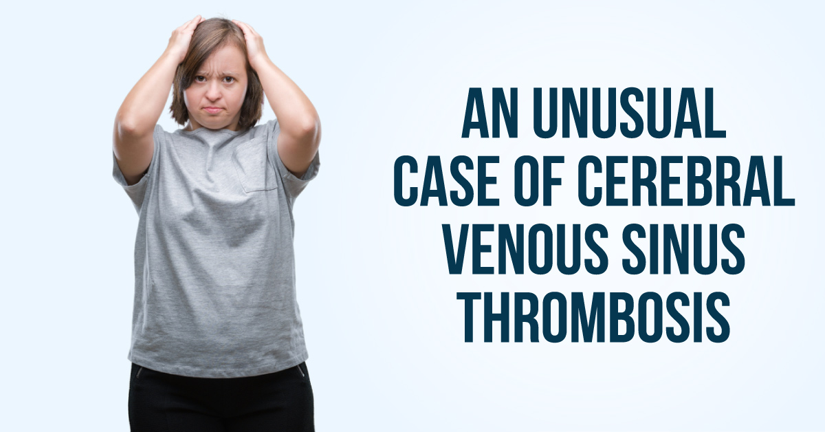Recurrent Spontaneous Subdural Hematoma as a Manifestation of Cerebral Venous Sinus Thrombosis