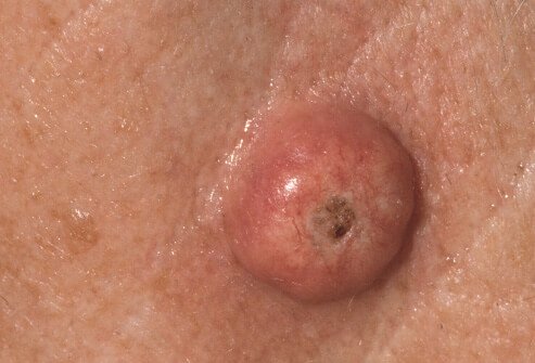 Determine The Differential Diagnosis