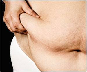 Immunity Status Of Sex Chromosome: More Obesity In Male