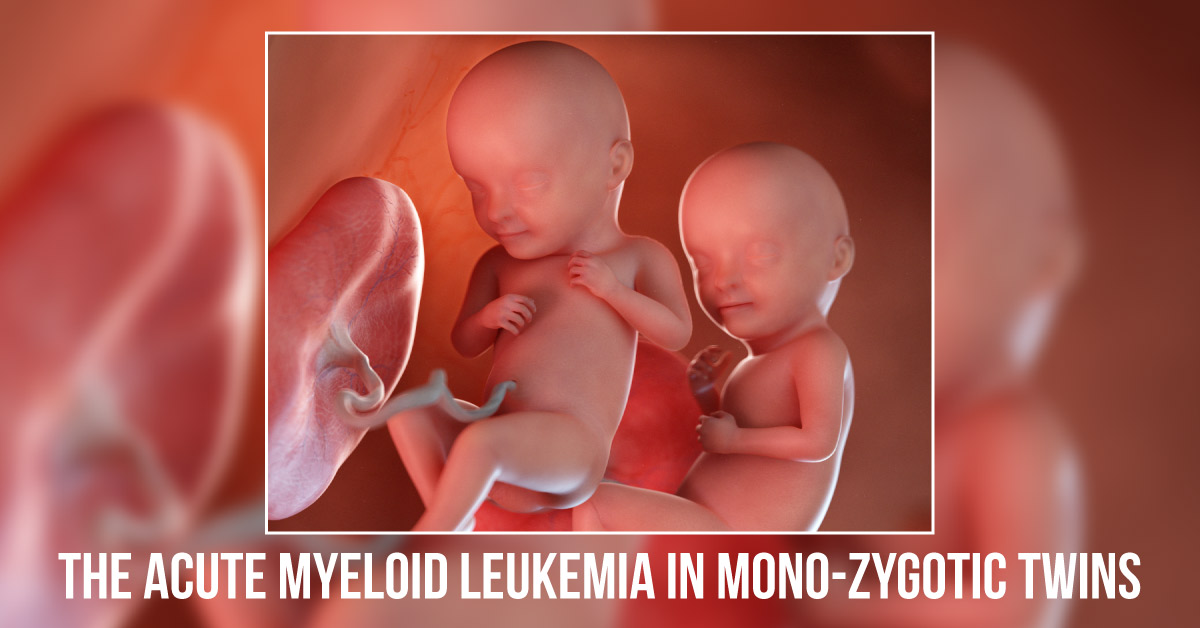 Effect of Cancer Treatment on Female Fertility