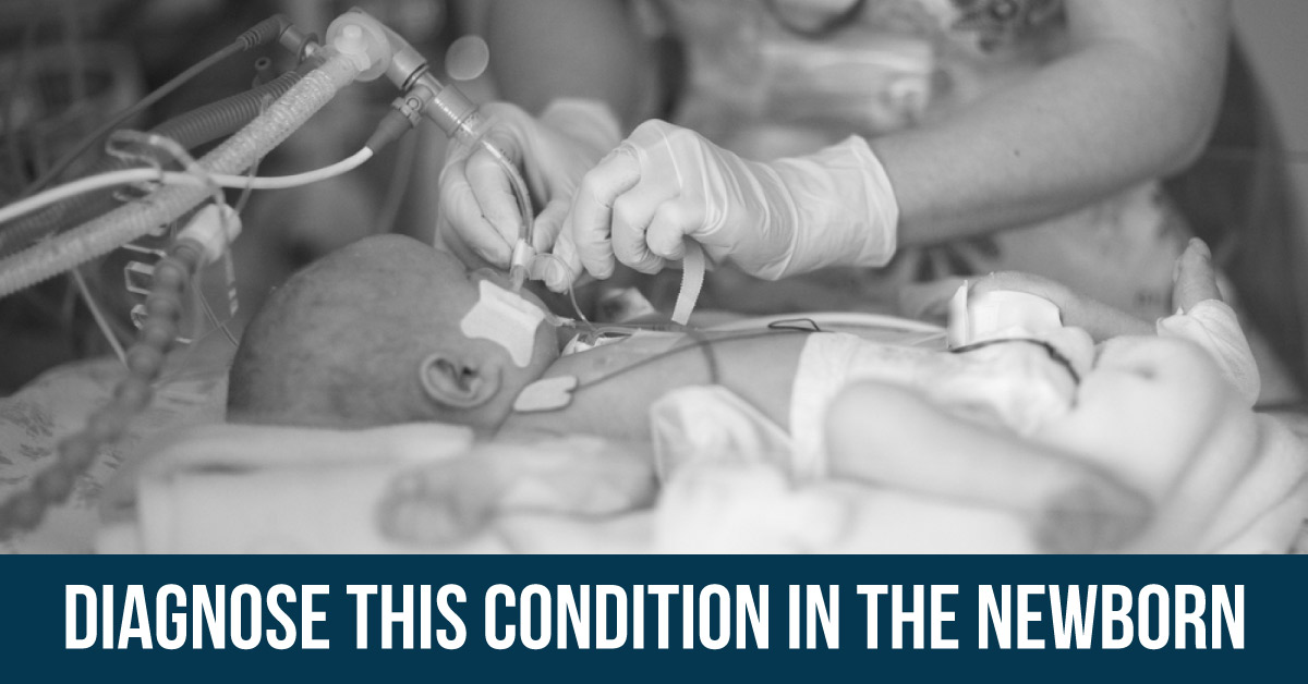 A 4-day-old Baby with Cardiovascular Complications