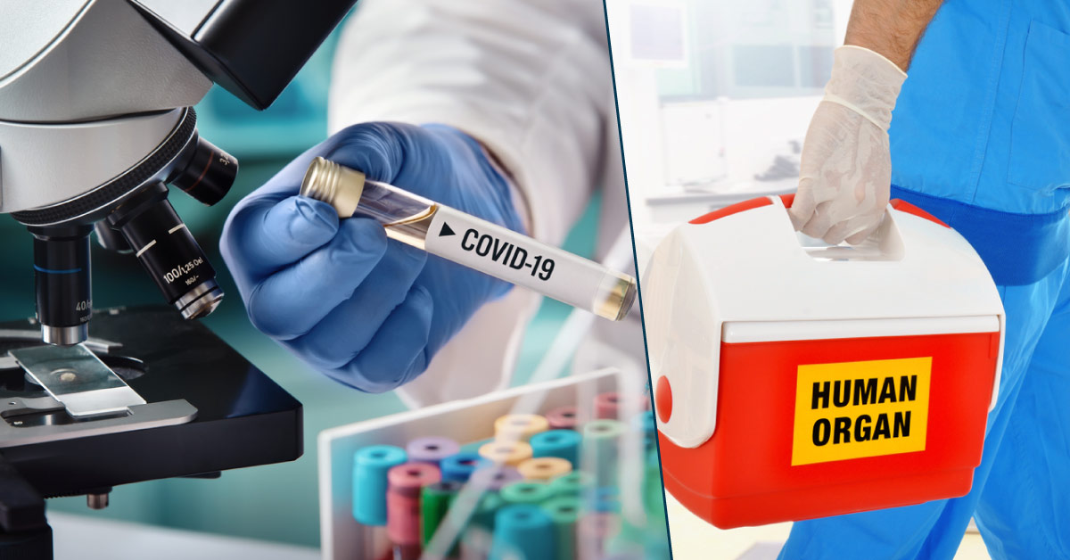 2019-nCoV - Information For Transplant Professionals