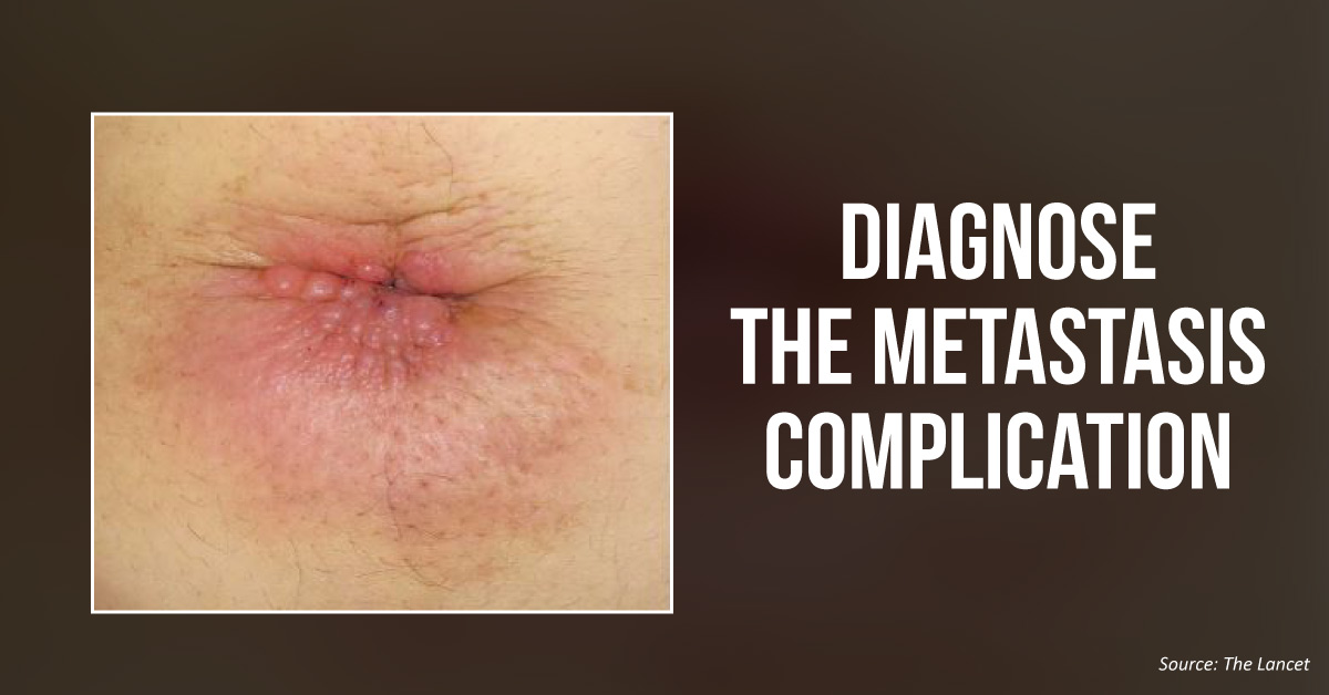 Diagnose This Umbilicus Condition