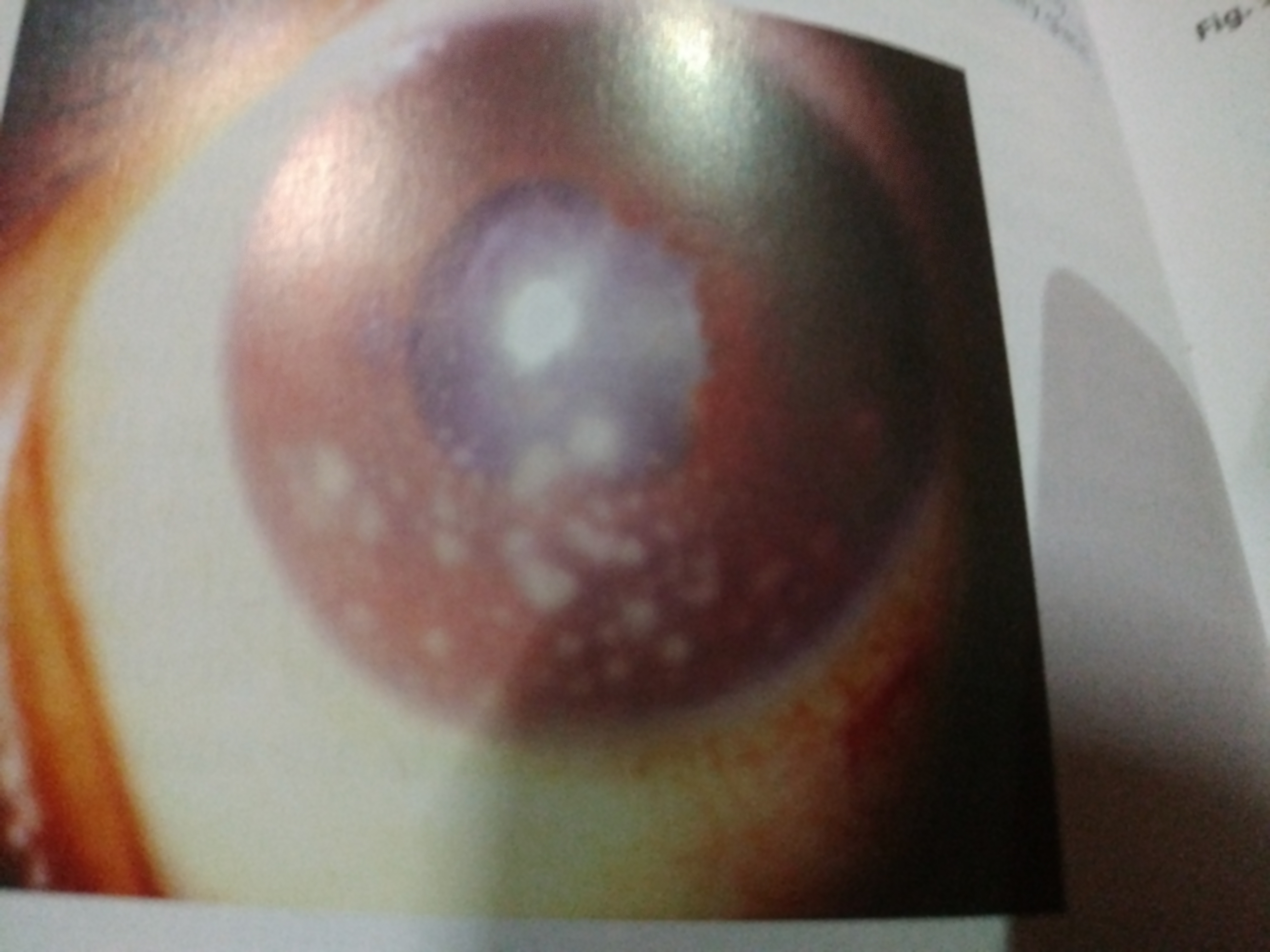 Spot The Diagnosis And Suggest Treatment?