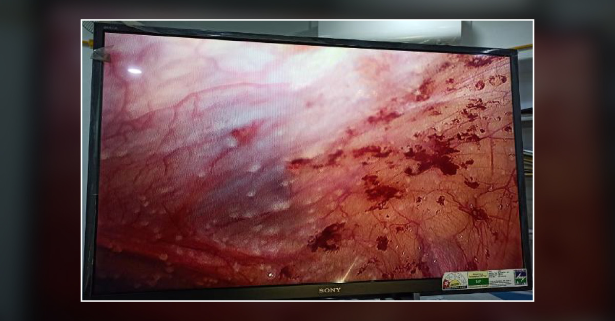 Case Related To Abdominal Pain