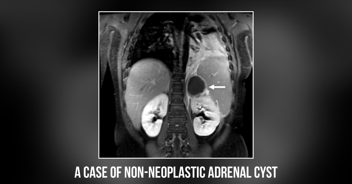 Diagnose This Patient's Condition