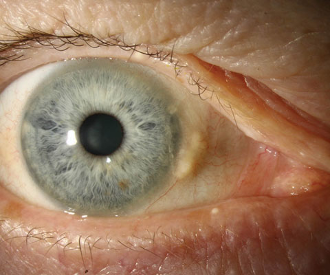 Spot The Diagnosis