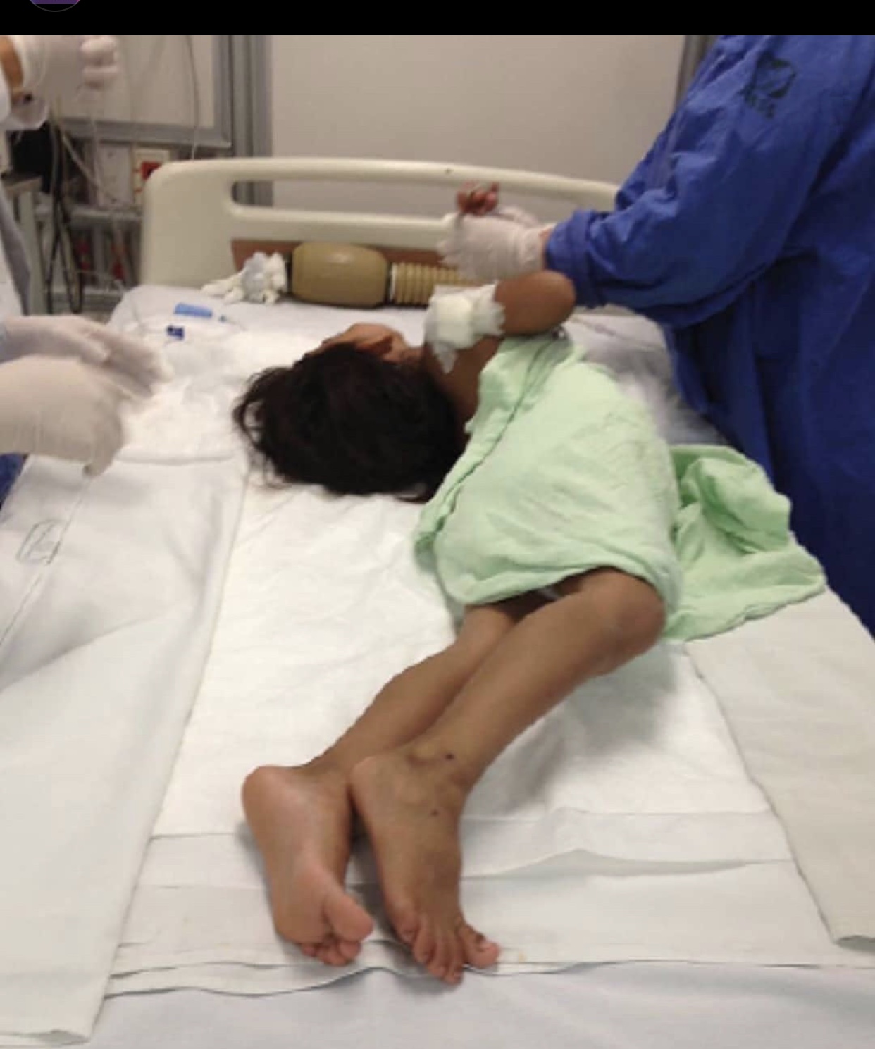 Case of Generalised Tetanus