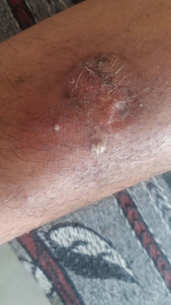 What Is This Skin Condition?