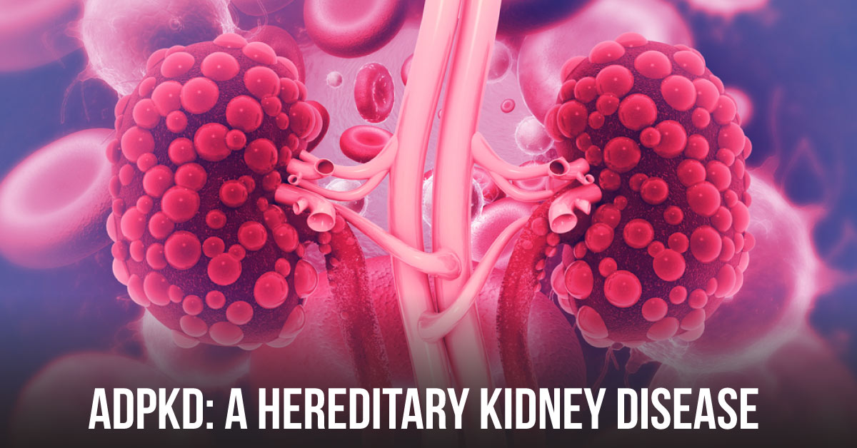 Autosomal Dominant Polycystic Kidney Disease: A Genetic Disorder