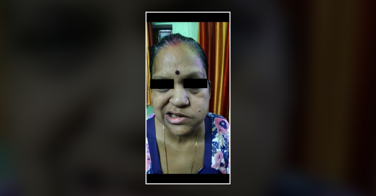 One More Case Of Facial Palsy