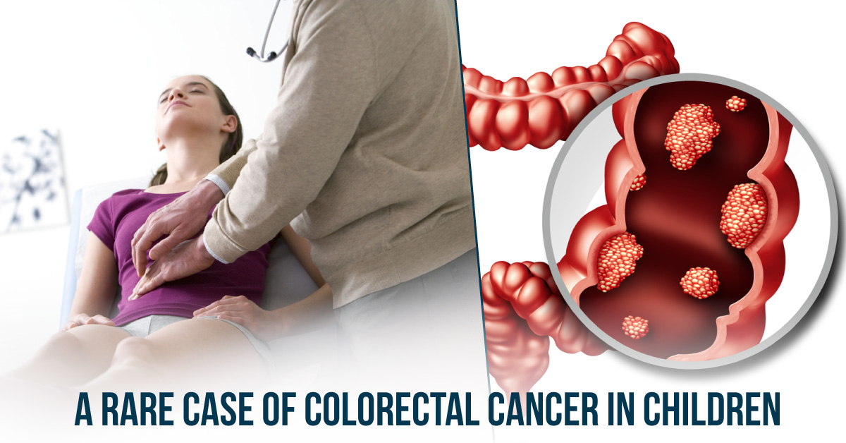 Colorectal Adenocarcinoma in Children: A Rare Case