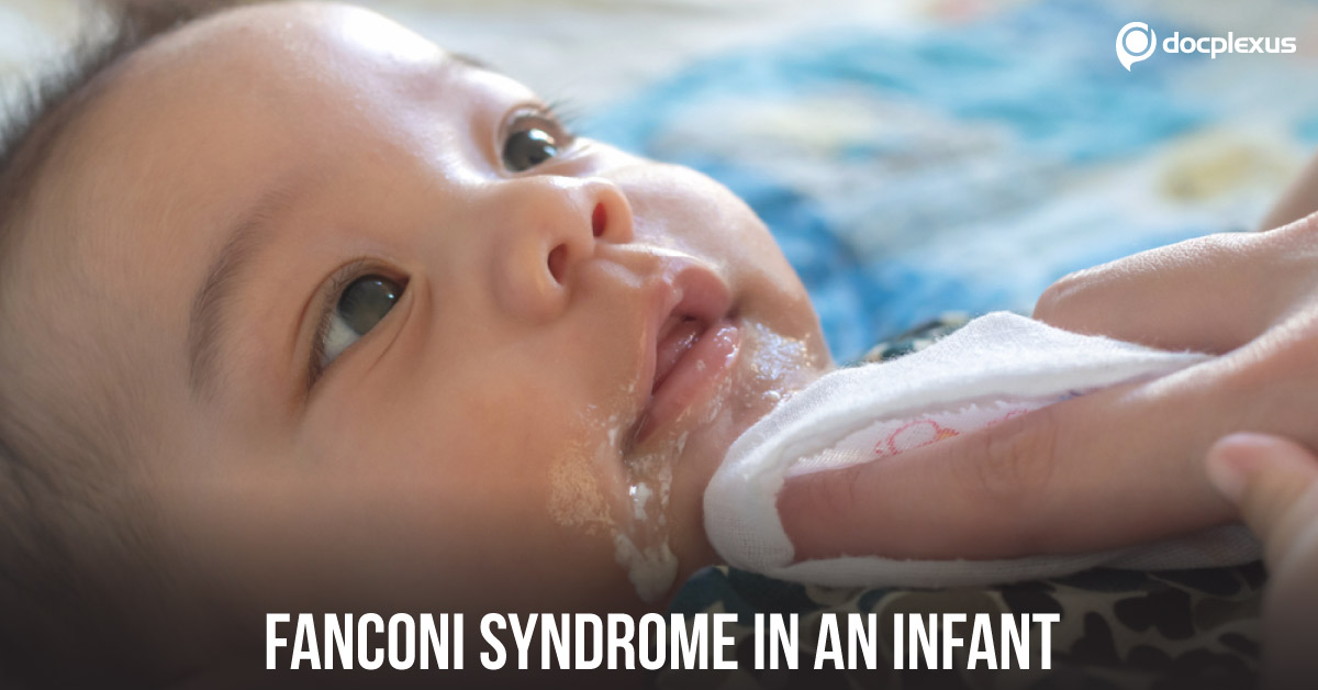 Fanconi Syndrome in an Infant