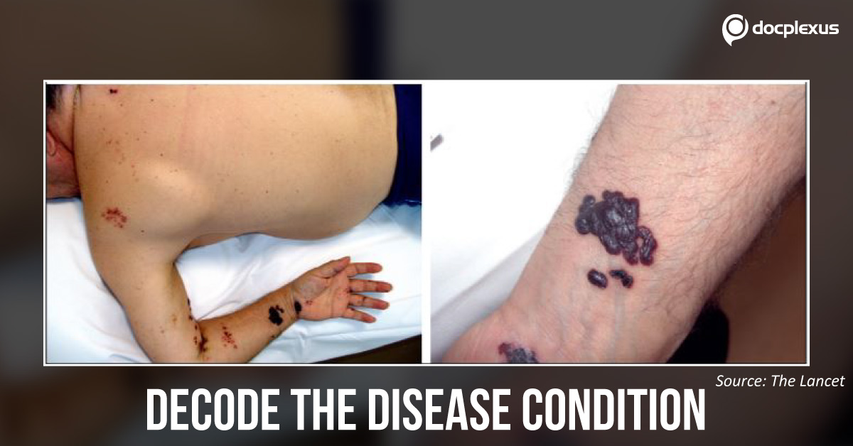 Diagnose The Sudden Appearance On The Skin