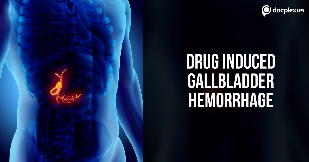 A Case Of Drug-Induced Gallbladder Hemorrhage